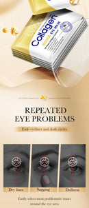 20pcs=10 Pairs SADOER Crystal Collagen Eye Mask Anti Dark Circles Remove Eyes Bags Moisturizing Eyes Patches Gel Masks Skin Care
