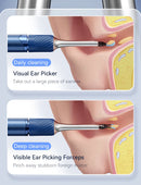 3 in 1 Wi-Fi Enabled Ear Pick Tweezers 12MP Camera Earwax Removal Tool with Rechargeable Battery Ear Cleaner with Tweezers Tools