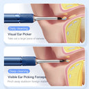 3 in 1 Wi-Fi Enabled Ear Pick Tweezers 12MP Camera Earwax Removal Tool with Rechargeable Battery Ear Cleaner with Tweezers Tools