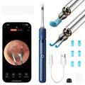 3 in 1 Wi-Fi Enabled Ear Pick Tweezers 12MP Camera Earwax Removal Tool with Rechargeable Battery Ear Cleaner with Tweezers Tools