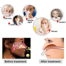Dispositivo para el tratamiento de la rinitis y la sinusitis - Rinite Therapy